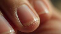 Human Thumbnail In Close Up — Stock Photo